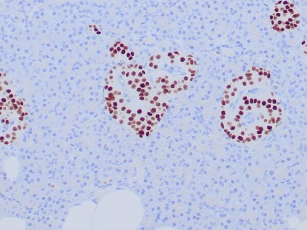 Immunohistochemistry (IHC) : Formalin-fixed, paraffin-embedded human pancreas stained with anti-INSM1 antibody using peroxidase-conjugate and DAB chromogen Note the nuclear staining of islet cells