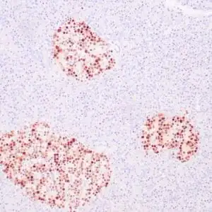 Immunohistochemistry (IHC) : Human pancreas stained with anti-INSM1 antibody using peroxidase-conjugate and DAB chromogen Note the nuclear staining of islet cells.
