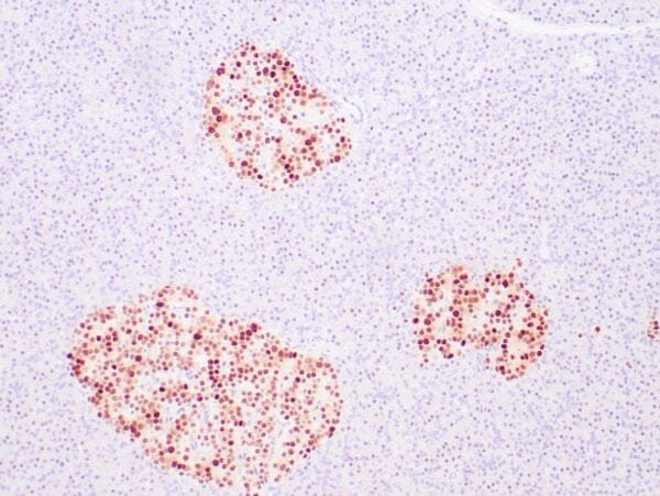 Immunohistochemistry (IHC) : Human pancreas stained with anti-INSM1 antibody using peroxidase-conjugate and DAB chromogen Note the nuclear staining of islet cells.