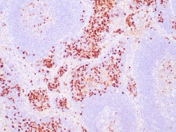 Immunohistochemistry (IHC) : Human tonsil stained with anti-Kappa light chain antibody using peroxidase-conjugate and DAB chromogen. Note the cytoplasmic staining of plasma cells.