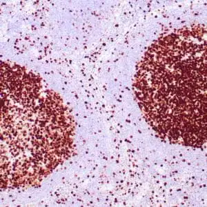 Immunohistochemistry (IHC) : Human lymph node stained with anti-Ki-67 antibody using peroxidase-conjugate and DAB chromogen. Note the nuclear staining of lymphocytes in follicles..