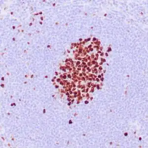 Immunohistochemistry (IHC) : Human tonsil stained with anti-Ki-67 antibody using peroxidase-conjugate and DAB chromogen. Note the nuclear staining of lymphocytes in a follicle.