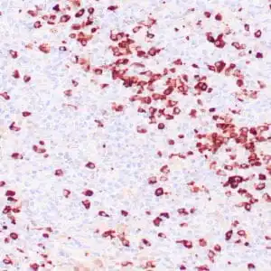 Immunohistochemistry (IHC) : Human tonsil stained with anti-Lambda light chain antibody using peroxidase-conjugate and DAB chromogen. Note cytoplasmic staining of plasma cells.