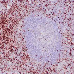 Immunohistochemistry (IHC) : Human tonsil stained with anti-LEF1 using peroxidase conjugate and DAB chromogen. Note nuclear staining of subset of B cells.