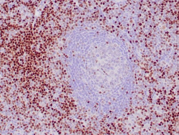 Immunohistochemistry (IHC) : Human tonsil stained with anti-LEF1 using peroxidase conjugate and DAB chromogen. Note nuclear staining of subset of B cells.