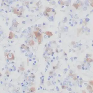 Immunohistochemistry (IHC) : Formalin-fixed, paraffin-embedded human pituitary stained with anti-FSH antibody using peroxidase-conjugate and DAB chromogen. Note the cytoplasmic staining of glandular cells