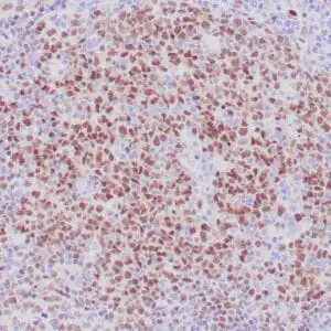 Immunohistochemistry (IHC) : Formalin-fixed, paraffin-embedded human lymph node stained with anti-LMO2 antibody using peroxidase-conjugate and AEC chromogen. Note nuclear staining of germinal center cells