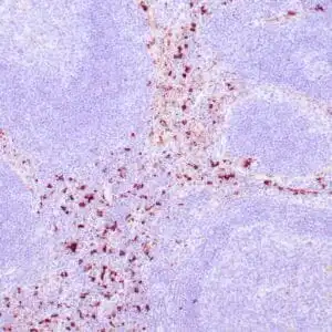 Immunohistochemistry (IHC) : Human lymph node stained with anti-Lysozyme antibody using peroxidase-conjugate and DAB chromogen. Note the cytoplasmic staining of perifollicular neutrophils and histiocytes..