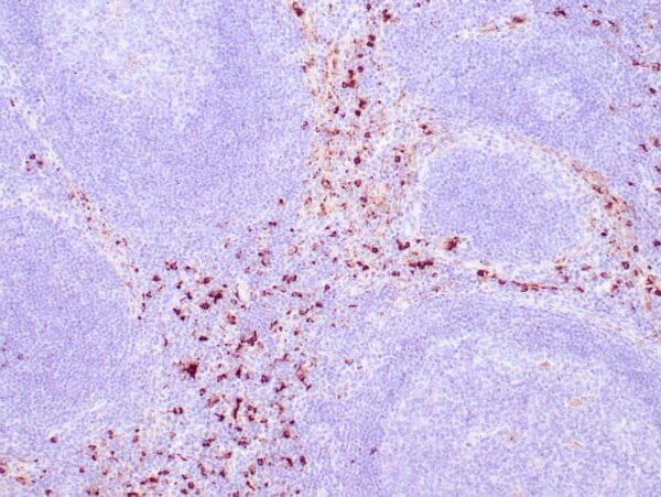 Immunohistochemistry (IHC) : Human lymph node stained with anti-Lysozyme antibody using peroxidase-conjugate and DAB chromogen. Note the cytoplasmic staining of perifollicular neutrophils and histiocytes..