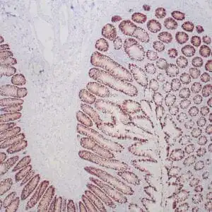 Immunohistochemistry (IHC) : Formalin-fixed, paraffin-embedded human normal colon stained with anti-MUC-2 antibody using peroxidase-conjugate and DAB chromogen. Note the cytoplasmic staining of tumor cells
