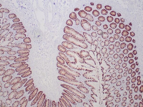 Immunohistochemistry (IHC) : Formalin-fixed, paraffin-embedded human normal colon stained with anti-MUC-2 antibody using peroxidase-conjugate and DAB chromogen. Note the cytoplasmic staining of tumor cells