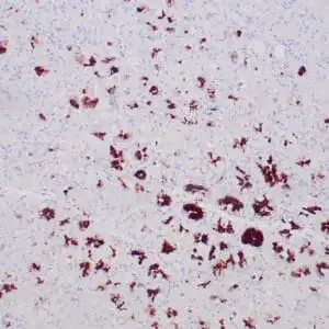 Immunohistochemistry (IHC) : Formalin-fixed, paraffin-embedded human stomach stained with anti MUC-5AC antibody using peroxidase-conjugate and DAB chromogen. Note the cytoplasmic staining of gastric body glands