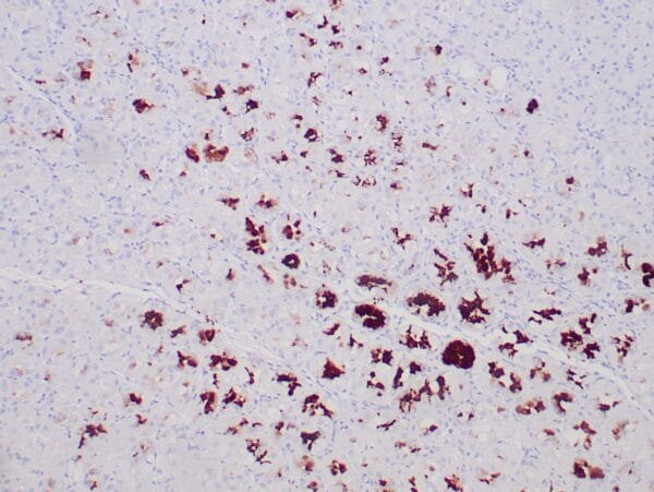 Immunohistochemistry (IHC) : Formalin-fixed, paraffin-embedded human stomach stained with anti MUC-5AC antibody using peroxidase-conjugate and DAB chromogen. Note the cytoplasmic staining of gastric body glands