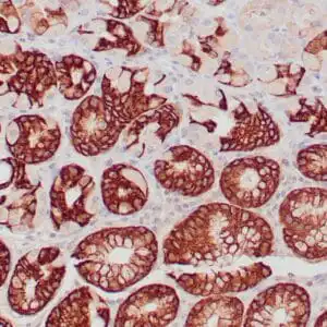 Immunohistochemistry (IHC) : Human gastric mucosa stained with anti MUC-5AC antibody using peroxidase-conjugate and DAB chromogen. Note the cytoplasmic staining of glandular cells.