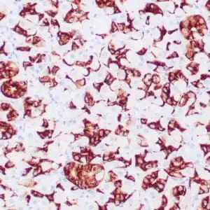 Immunohistochemistry (IHC) : Human gastric mucosa stained with anti-MUC-6 antibody using peroxidase-conjugate and DAB chromogen. Note the cytoplasmic staining of glandular cells.