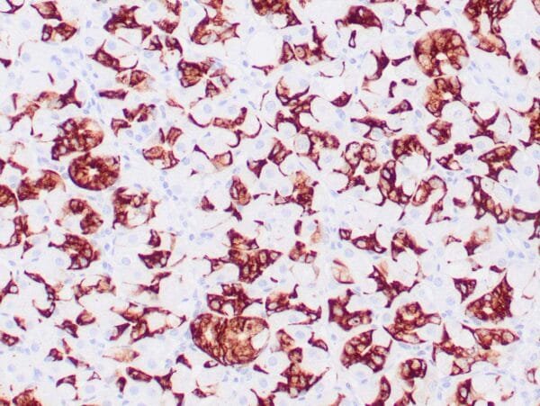 Immunohistochemistry (IHC) : Human gastric mucosa stained with anti-MUC-6 antibody using peroxidase-conjugate and DAB chromogen. Note the cytoplasmic staining of glandular cells.