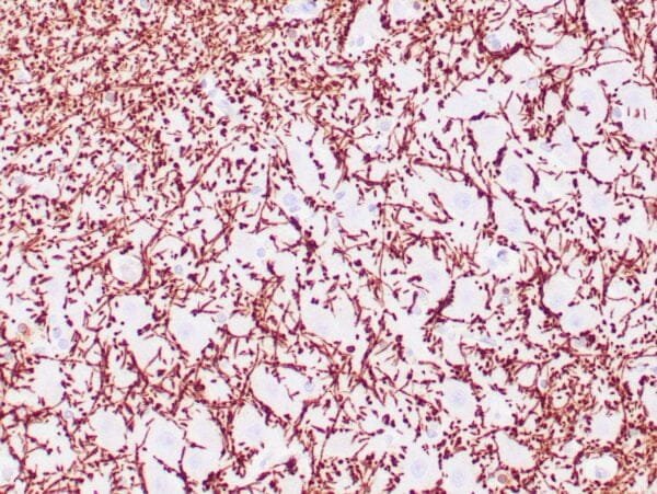 Immunohistochemistry (IHC) : Human brain white mater stained with anti-MBP antibody using peroxidase-conjugate and DAB chromogen. Note the cytoplasmic staining of glial cells.