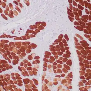 Immunohistochemistry (IHC) : Formalin-fixed, paraffin-embedded human skeletal muscle stained with anti-myoglobin antibody using peroxidase-conjugate and DAB chromogen. Note the cytoplasmic staining of skeletal muscle fibers.