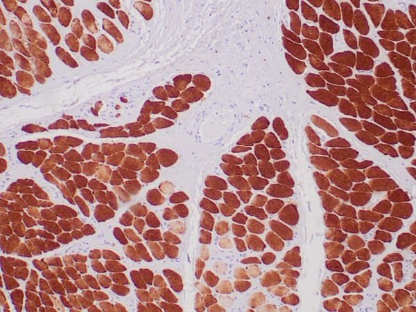 Immunohistochemistry (IHC) : Formalin-fixed, paraffin-embedded human skeletal muscle stained with anti-myoglobin antibody using peroxidase-conjugate and DAB chromogen. Note the cytoplasmic staining of skeletal muscle fibers.