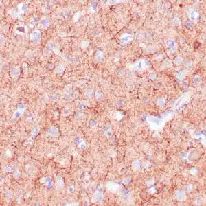Immunohistochemistry (IHC) : Human cerebellum stained with anti-Neurofilament antibody using peroxidase-conjugate and DAB chromogen. Note the cytoplasmic staining of neurons and neuronal processes.