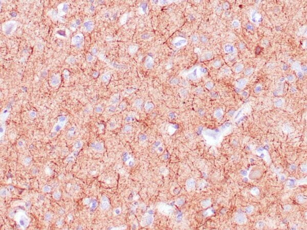 Immunohistochemistry (IHC) : Human cerebellum stained with anti-Neurofilament antibody using peroxidase-conjugate and DAB chromogen. Note the cytoplasmic staining of neurons and neuronal processes.