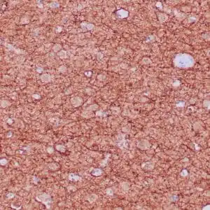 Immunohistochemistry (IHC) : Formalin-fixed, paraffin-embedded human cerebellum stained with anti-neurofilament antibody using peroxidase-conjugate and DAB chromogen. Note the cytoplasmic staining of neurons and neuronal processes