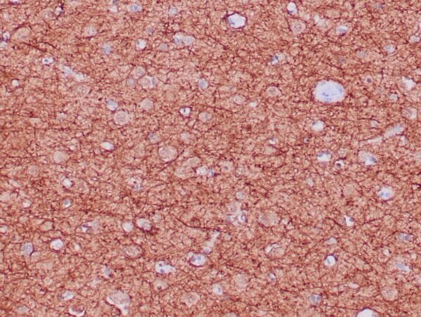 Immunohistochemistry (IHC) : Formalin-fixed, paraffin-embedded human cerebellum stained with anti-neurofilament antibody using peroxidase-conjugate and DAB chromogen. Note the cytoplasmic staining of neurons and neuronal processes