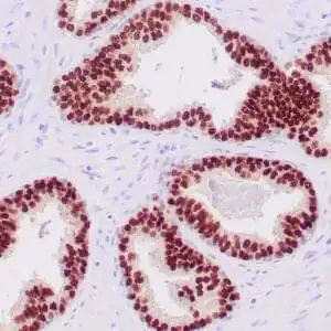 Immunohistochemistry (IHC) : Human prostate stained with anti-NKX3.1 antibody using peroxidase-conjugate and DAB chromogen. Note nuclear staining of glandular cells.