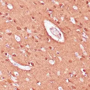 Immunohistochemistry (IHC) : Human cerebellum stained with anti-NSE antibody using peroxidase-conjugate and DAB chromogen. Note cytoplasmic staining of neuronal cells.