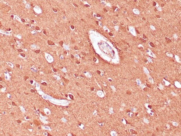 Immunohistochemistry (IHC) : Human cerebellum stained with anti-NSE antibody using peroxidase-conjugate and DAB chromogen. Note cytoplasmic staining of neuronal cells.