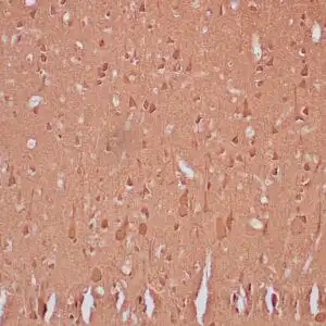 Immunohistochemistry (IHC) : Human cerebellum stained with anti-NSE antibody using peroxidase-conjugate and DAB chromogen. Note cytoplasmic staining of neuronal cells.