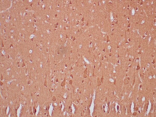 Immunohistochemistry (IHC) : Human cerebellum stained with anti-NSE antibody using peroxidase-conjugate and DAB chromogen. Note cytoplasmic staining of neuronal cells.