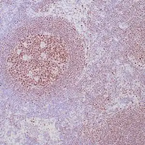 Immunohistochemistry (IHC) : Formalin-fixed, paraffin-embedded human lymph node stained with anti-OCT2 antibody using peroxidase-conjugate and DAB chromogen.  Note nuclear staining of follicular B cells