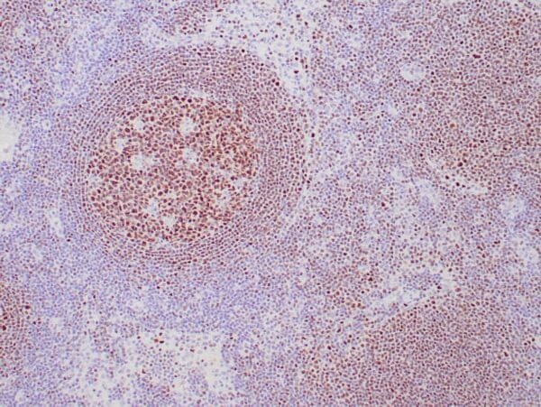 Immunohistochemistry (IHC) : Formalin-fixed, paraffin-embedded human lymph node stained with anti-OCT2 antibody using peroxidase-conjugate and DAB chromogen.  Note nuclear staining of follicular B cells