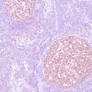 Immunohistochemistry (IHC) : Human lymph node stained with anti-OCT-2 antibody using peroxidase-conjugate and DAB chromogen. Note nuclear staining of follicular center B cells.