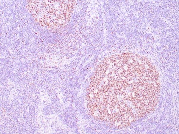 Immunohistochemistry (IHC) : Human lymph node stained with anti-OCT-2 antibody using peroxidase-conjugate and DAB chromogen. Note nuclear staining of follicular center B cells.