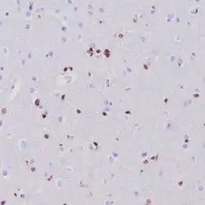 Immunohistochemistry (IHC) : Human cerebrum stained with anti-Olig 2 antibody using peroxidase-conjugate and DAB chromogen. Note the nuclear staining of oligodendroglial cells.