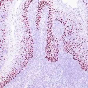 Immunohistochemistry (IHC) : Human tonsil stained with anti-p40 antibody using peroxidase-conjugate and DAB chromogen. Note the nuclear staining of squamous epithelium..