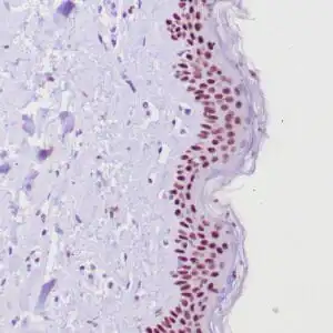 Immunohistochemistry (IHC) : Human skin stained with anti-p63 using peroxidase conjugate and DAB chromogen. Note nuclear staining of basal cells.