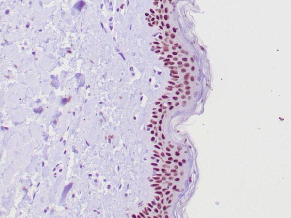 Immunohistochemistry (IHC) : Human skin stained with anti-p63 using peroxidase conjugate and DAB chromogen. Note nuclear staining of basal cells.