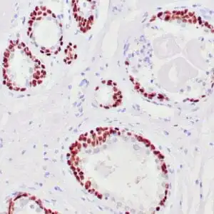 Immunohistochemistry (IHC) : Human breast stained with anti-p63 using peroxidase-conjugate and DAB chromogen. Note nuclear staining of myoepithelial cells.