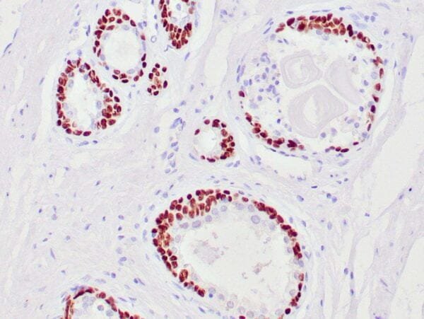 Immunohistochemistry (IHC) : Human breast stained with anti-p63 using peroxidase-conjugate and DAB chromogen. Note nuclear staining of myoepithelial cells.