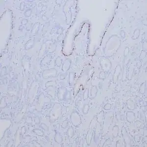 Immunohistochemistry (IHC) : Human breast stained with anti-p63 using peroxidase-conjugate and DAB chromogen. Note nuclear staining of myoepithelial cells.
