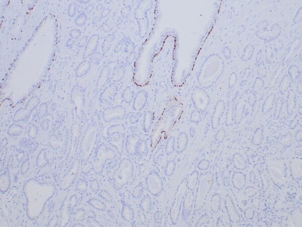 Immunohistochemistry (IHC) : Human breast stained with anti-p63 using peroxidase-conjugate and DAB chromogen. Note nuclear staining of myoepithelial cells.