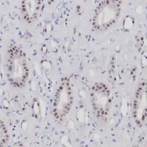 Immunohistochemistry (IHC) : Formalin-fixed, paraffin-embedded human normal kidney stained with anti-PAX-2 antibody using peroxidase-conjugate and DAB chromogen. Note nuclear staining of tubular cells