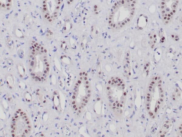 Immunohistochemistry (IHC) : Formalin-fixed, paraffin-embedded human normal kidney stained with anti-PAX-2 antibody using peroxidase-conjugate and DAB chromogen. Note nuclear staining of tubular cells