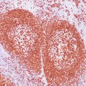 Immunohistochemistry (IHC) : Human lymph node stained with anti-PAX-5 antibody using peroxidase-conjugate and DAB chromogen. Note the nuclear staining in B cells in follicle.