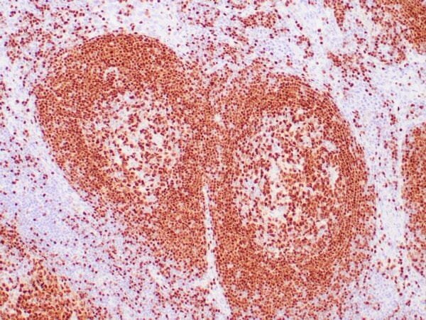 Immunohistochemistry (IHC) : Human lymph node stained with anti-PAX-5 antibody using peroxidase-conjugate and DAB chromogen. Note the nuclear staining in B cells in follicle.