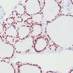 Immunohistochemistry (IHC) : Human thyroid gland stained with anti-PAX-8 antibody using peroxidase-conjugate and DAB chromogen. Note nuclear stain of follicular cells.