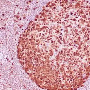 Immunohistochemistry (IHC) : Human tonsil stained with anti-PCNA antibody using peroxidase-conjugate and DAB chromogen. Note the nuclear staining of lymphoid cells.